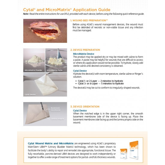 MicroMatrix®  ACell’s wound management products